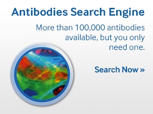 fisher-scientific-antibodies-search-feature